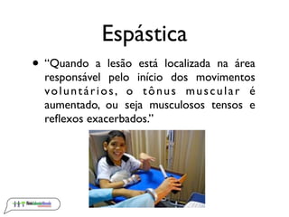 Espástica
• “Quando   a lesão está localizada na área
  responsável pelo início dos movimentos
  voluntários, o tônus muscular é
  aumentado, ou seja musculosos tensos e
  reﬂexos exacerbados.”
 