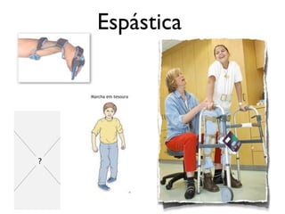 Espástica
 