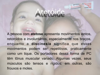 Atetóide

A pessoa com atetose apresenta movimentos lentos,
retorcidos e involuntários, especialmente nos braços,
enquanto a discinesia significa que esses
movimentos podem ser repetitivos, praticamente
como um tique. Os portadores dessa forma de PC
têm tônus muscular variado. Algumas vezes, seus
músculos são tensos e rígidos; em outras, são
frouxos e moles.
 