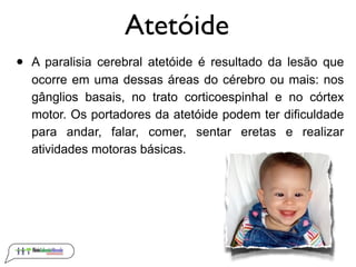 Atetóide
•   A paralisia cerebral atetóide é resultado da lesão que
    ocorre em uma dessas áreas do cérebro ou mais: nos
    gânglios basais, no trato corticoespinhal e no córtex
    motor. Os portadores da atetóide podem ter dificuldade
    para andar, falar, comer, sentar eretas e realizar
    atividades motoras básicas.
 