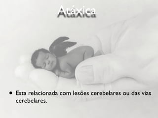 Atáxica




• Esta relacionada com lesões cerebelares ou das vias
  cerebelares.
 
