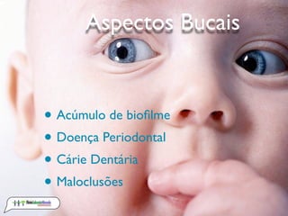 Aspectos Bucais


• Acúmulo de bioﬁlme
• Doença Periodontal
• Cárie Dentária
• Maloclusões
 