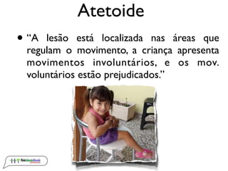 Atetoide
• “A lesão está localizada nas áreas que
 regulam o movimento, a criança apresenta
 movimentos involuntários, e o...