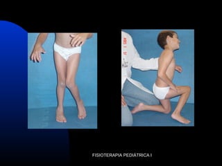 FISIOTERAPIA PEDIÁTRICA I
 