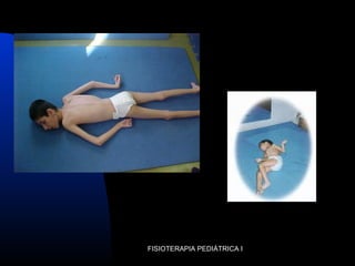 FISIOTERAPIA PEDIÁTRICA I
 