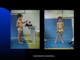 FISIOTERAPIA PEDIÁTRICA I
 