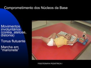 Movimentos
involuntários
(coréia, atetose,
distonia)
Tonus flutuante
Marcha em
“marionete”
FISIOTERAPIA PEDIÁTRICA I
Comprometimento dos Núcleos da Base
 