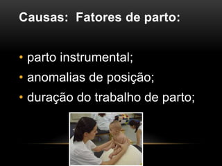 Causas: Fatores de parto:
• parto instrumental;
• anomalias de posição;
• duração do trabalho de parto;
 