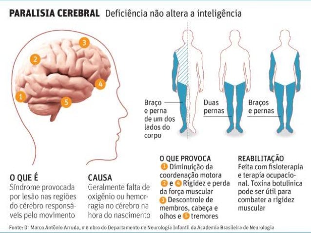Paralisia cerebral