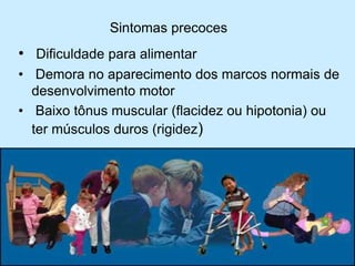 Sintomas precoces
• Dificuldade para alimentar
• Demora no aparecimento dos marcos normais de
desenvolvimento motor
• Baixo tônus muscular (flacidez ou hipotonia) ou
ter músculos duros (rigidez)
 