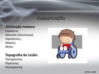 Disfunção motora:
Espástico;
Atetóide (Discinesia);
Hipotônico.;
Atáxico;
Misto.
Topografia da Lesão:
Tetraparesia;
Diparesia;
Hemiparesia.
CLASSIFICAÇÃO
APCB, 2009
 