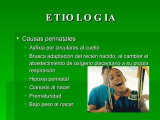 ETIOLOGIA Causas perinatales Asfixia por circulares al cuello Brusca adaptación del recién nacido, al cambiar el abastecimiento de oxígeno placentario a su propia respiración Hipoxia perinatal Cianosis al nacer Prematuridad Bajo peso al nacer 