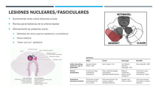 Lesiones Raras Parálisis del III Nervio Craneal | PDF