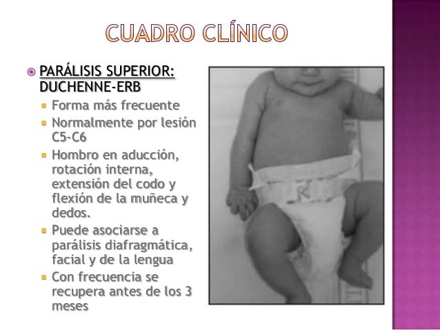 erb duchenne