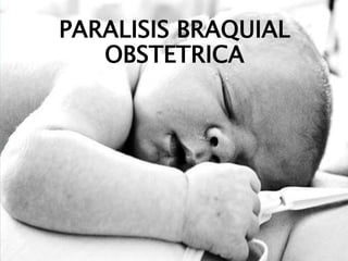 PARALISIS BRAQUIAL 
OBSTETRICA 
 