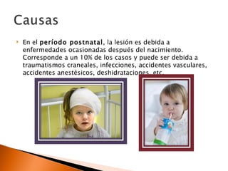    En el período postnatal, la lesión es debida a
    enfermedades ocasionadas después del nacimiento.
    Corresponde a un 10% de los casos y puede ser debida a
    traumatismos craneales, infecciones, accidentes vasculares,
    accidentes anestésicos, deshidrataciones, etc.
 