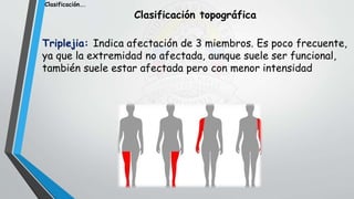 Clasificación topográfica
Triplejia: Indica afectación de 3 miembros. Es poco frecuente,
ya que la extremidad no afectada, aunque suele ser funcional,
también suele estar afectada pero con menor intensidad
Clasificación….
 