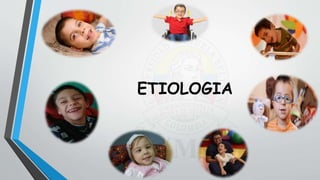 ETIOLOGIA
 