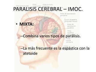 PARALISIS CEREBRAL – IMOC.

• MIXTA:

  –Combina varios tipos de parálisis.

  –La más frecuente es la espástica con la
   atetoide
 