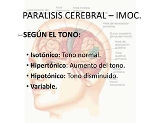 PARALISIS CEREBRAL – IMOC.
–SEGÚN EL TONO:

 • Isotónico: Tono normal.
 • Hipertónico: Aumento del tono.
 • Hipotónico: Tono disminuido.
 • Variable.
 