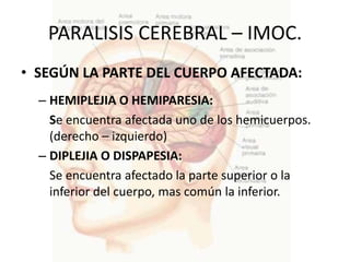 PARALISIS CEREBRAL – IMOC.
• SEGÚN LA PARTE DEL CUERPO AFECTADA:
  – HEMIPLEJIA O HEMIPARESIA:
    Se encuentra afectada uno de los hemicuerpos.
    (derecho – izquierdo)
  – DIPLEJIA O DISPAPESIA:
    Se encuentra afectado la parte superior o la
    inferior del cuerpo, mas común la inferior.
 