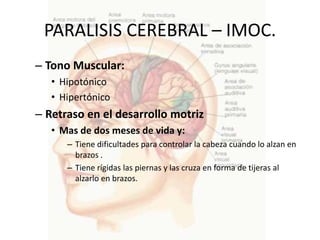 PARALISIS CEREBRAL – IMOC.
– Tono Muscular:
   • Hipotónico
   • Hipertónico
– Retraso en el desarrollo motriz
   • Mas de dos meses de vida y:
      – Tiene dificultades para controlar la cabeza cuando lo alzan en
        brazos .
      – Tiene rígidas las piernas y las cruza en forma de tijeras al
        alzarlo en brazos.
 