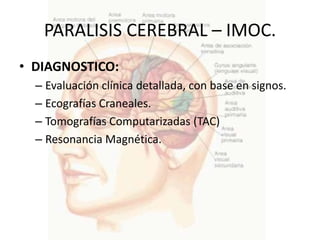 PARALISIS CEREBRAL – IMOC.
• DIAGNOSTICO:
  – Evaluación clínica detallada, con base en signos.
  – Ecografías Craneales.
  – Tomografías Computarizadas (TAC)
  – Resonancia Magnética.
 