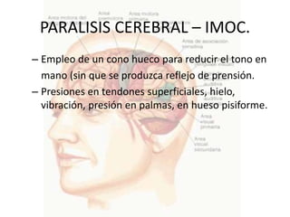 PARALISIS CEREBRAL – IMOC.
– Empleo de un cono hueco para reducir el tono en
  mano (sin que se produzca reflejo de prensión.
– Presiones en tendones superficiales, hielo,
  vibración, presión en palmas, en hueso pisiforme.
 
