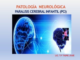 PATOLOGÍA NEUROLÓGICA
PARALISIS CEREBRAL INFANTIL (PCI)
LIC. T.F TIGRE JOSÉ
 