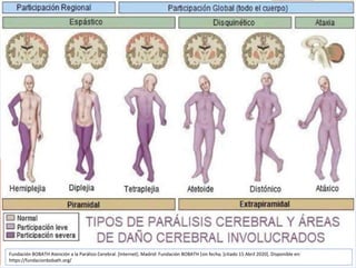 Fundación BOBATH Atención a la Parálisis Cerebral. [Internet]. Madrid: Fundación BOBATH [sin fecha; [citado 15 Abril 2020]. Disponible en:
https://fundacionbobath.org/
 