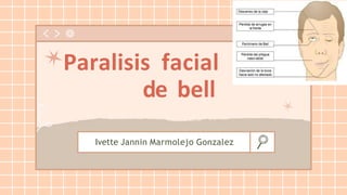 Ivette Jannin Marmolejo Gonzalez
Paralisis facial
de bell
 