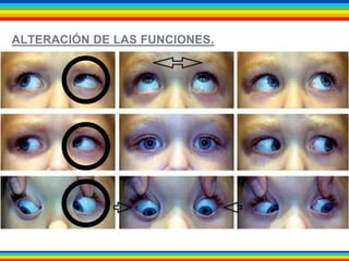 ALTERACIÓN DE LAS FUNCIONES. 
 