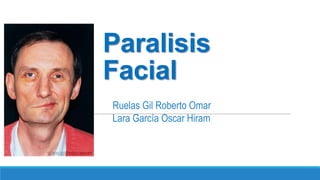 Paralisis
Facial
Ruelas Gil Roberto Omar
Lara García Oscar Hiram
 