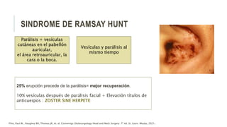 SINDROME DE RAMSAY HUNT
25% erupción precede de la parálisis= mejor recuperación.
10% vesículas después de parálisis facial + Elevación títulos de
anticuerpos : ZOSTER SINE HERPETE
Flint, Paul W., Haughey BH, Thomas JR, et. al. Cummings Otolaryngology Head and Neck Surgery. 7ª ed. St. Louis: Mosby, 2021.
Parálisis + vesículas
cutáneas en el pabellón
auricular,
el área retroauricular, la
cara o la boca.
Vesículas y parálisis al
mismo tiempo
 