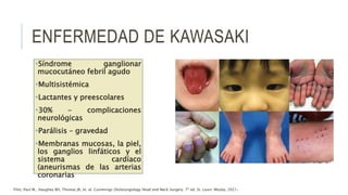 ENFERMEDAD DE KAWASAKI
Síndrome ganglionar
mucocutáneo febril agudo
Multisistémica
Lactantes y preescolares
30% - complicaciones
neurológicas
Parálisis – gravedad
Membranas mucosas, la piel,
los ganglios linfáticos y el
sistema cardíaco
(aneurismas de las arterias
coronarias
Flint, Paul W., Haughey BH, Thomas JR, et. al. Cummings Otolaryngology Head and Neck Surgery. 7ª ed. St. Louis: Mosby, 2021.
 