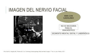 IMAGEN DEL NERVIO FACIAL
RMN CON
GADOLINEO
NO ES NECESARIA
PARA EL
DIAGNÓSTICO
SEGMENTO MEATAL DISTAL Y LABERÍNTICO
Flint, Paul W., Haughey BH, Thomas JR, et. al. Cummings Otolaryngology Head and Neck Surgery. 7ª ed. St. Louis: Mosby, 2021.
 
