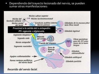  Dependiendo del trayecto lesionado del nervio, se pueden
  sumar otras manifestaciones:




     Proximal a la salida del n.estapedio:
          PF+ ageusia + algiacusia.
 