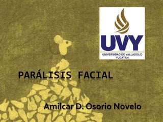 PARÁLISIS FACIAL

    Amilcar D. Osorio Novelo
 
