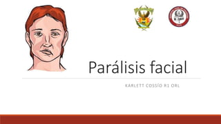Parálisis facial
KARLETT COSSÍO R1 ORL
 