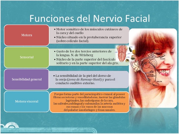 Paralisis facial periferica