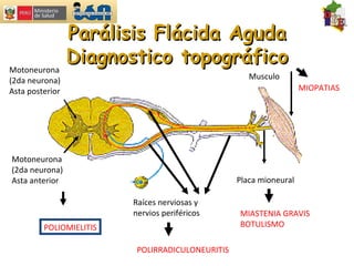 Motoneurona (2da neurona) Asta anterior Motoneurona (2da neurona) Asta posterior POLIOMIELITIS Raíces nerviosas y  nervios periféricos Placa mioneural Musculo POLIRRADICULONEURITIS MIASTENIA GRAVIS BOTULISMO MIOPATIAS Parálisis Flácida Aguda Diagnostico topográfico 