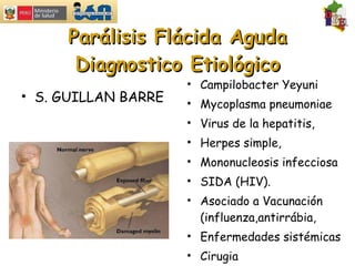 Parálisis Flácida Aguda Diagnostico Etiológico Campilobacter Yeyuni  Mycoplasma pneumoniae Virus de la hepatitis,  Herpes simple, Mononucleosis infecciosa  SIDA (HIV). Asociado a Vacunación (influenza,antirrábia, Enfermedades sistémicas Cirugia S. GUILLAN BARRE 
