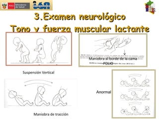 3.Examen neurológico Tono y fuerza muscular lactante Maniobra de tracción Suspensión Vertical Maniobra al borde de la cama POLIO Anormal 