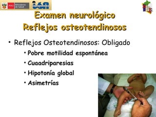 Examen neurológico Reflejos osteotendinosos Reflejos Osteotendinosos: Obligado Pobre motilidad espontánea Cuaadriparesias Hipotonía global Asimetrías 
