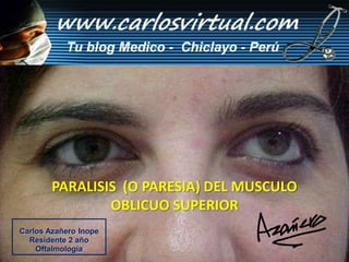 PARALISIS  (O PARESIA) DEL MUSCULO  OBLICUO SUPERIOR Carlos Azañero Inope Residente 2 año Oftalmología 