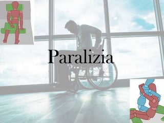 Paralizia
 