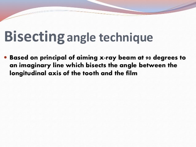 parallel angle technique vs bisecting angle technique paralleling technique