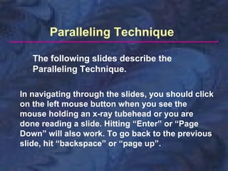 Paralleling Technique
The following slides describe the
Paralleling Technique.
In navigating through the slides, you should click
on the left mouse button when you see the
mouse holding an x-ray tubehead or you are
done reading a slide. Hitting “Enter” or “Page
Down” will also work. To go back to the previous
slide, hit “backspace” or “page up”.

 