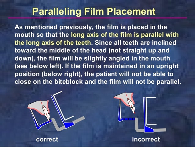 paralleling technique