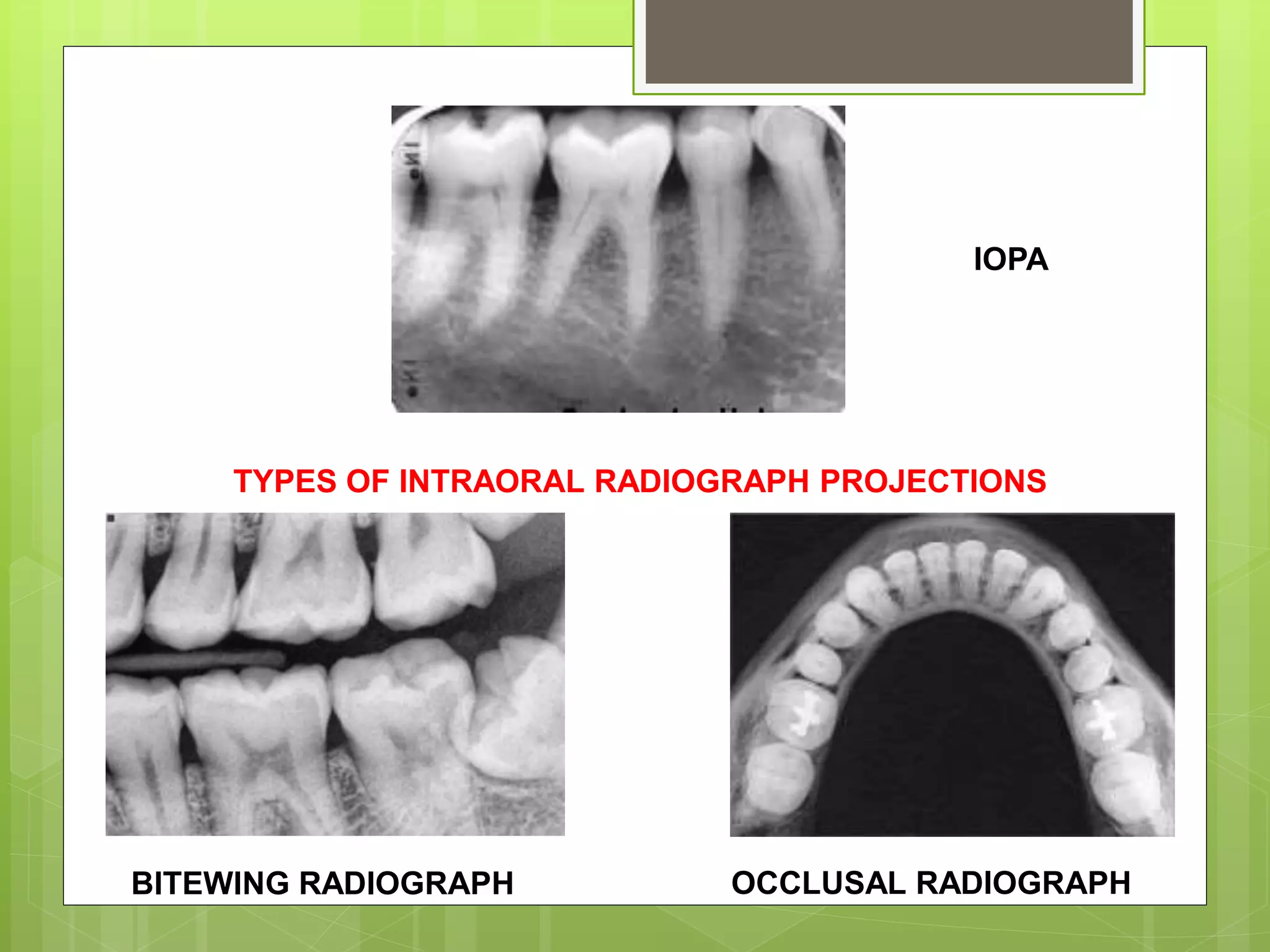 Paralleling and bisecting radiographic techniques | PPTX